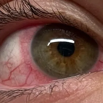 Marcos Terrones